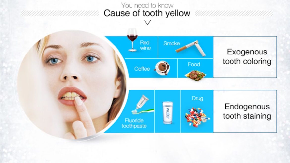 Best-Ways-to-Clean-Teeth-with-Whitening-Strips-Smoking-Coffee-and-Tea-Stains
